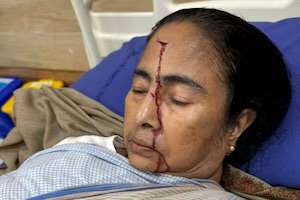 Bengal CM Mamata Banerjee Sustains 'Major Injury', Modi Wishes Her Speedy Recovery